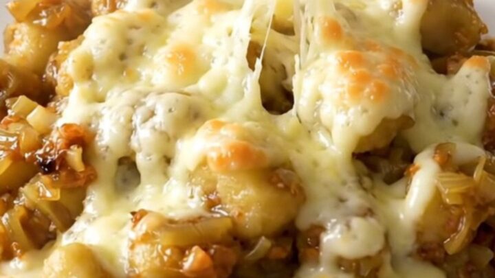 A close-up of a bowl filled with soft potato gnocchi in a rich, onion-filled broth topped with melted, bubbly Swiss cheese.