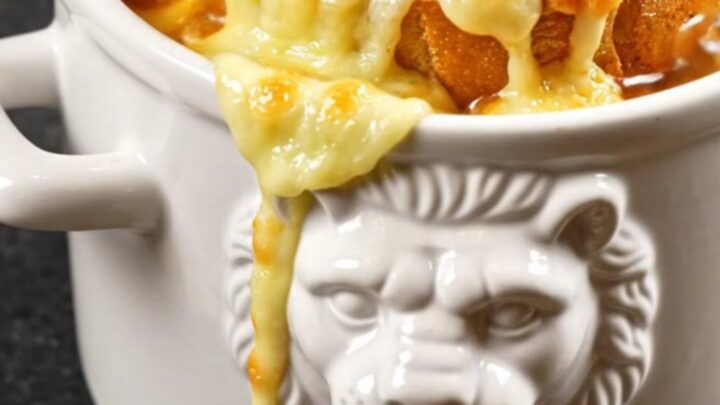 A ceramic crock filled with rich French onion soup, topped with a bubbling, golden brown layer of melted Gruyere cheese.